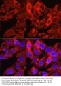 Proprotein Convertase Subtilisin/Kexin Type 9 (PCSK9) Antibody