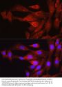 Proprotein Convertase Subtilisin/Kexin Type 9 (PCSK9) Antibody