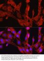 Proprotein Convertase Subtilisin/Kexin Type 9 (PCSK9) Antibody