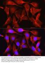 Proprotein Convertase Subtilisin/Kexin Type 9 (PCSK9) Antibody