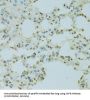 Scaffold Attachment Factor B1 (SAFB) Antibody