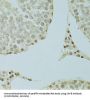 Scaffold Attachment Factor B1 (SAFB) Antibody
