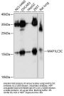 Microtubule Associated Protein 1 Light Chain 3 Gamma (MAP1LC3C) Antibody