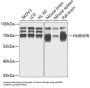 Heterogeneous Nuclear Ribonucleoprotein R (HNRNPR) Antibody