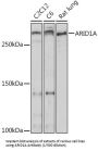 BRG1-Associated Factor 250 (BAF250) Antibody