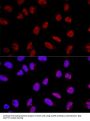 A-Kinase Anchor Protein 8 (AKAP8) Antibody