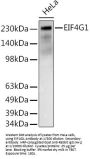Eukaryotic Translation Initiation Factor 4 Gamma 1 (EIF4G1) Antibody