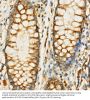 Eukaryotic Translation Initiation Factor 4 Gamma 1 (EIF4G1) Antibody
