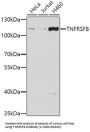 Tumor Necrosis Factor Receptor Superfamily Member 8 / CD30 (TNFRSF8) Antibody