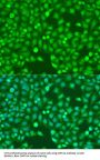 Myocyte Enhancer Factor 2A (MEF2A) Antibody