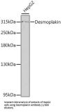 Desmoplakin (DSP) Antibody