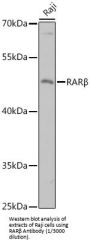 Retinoic Acid Receptor Beta (RARB) Antibody
