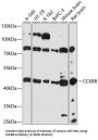 Gastrin/Cholecystokinin Type B Receptor (CCKBR) Antibody
