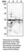 Secreted Protein, Acidic, Cysteine-Rich / Osteonectin (SPARC) Antibody