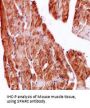 Secreted Protein, Acidic, Cysteine-Rich / Osteonectin (SPARC) Antibody
