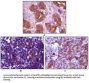 Tyrosine-Protein Kinase BLK (BLK) Antibody