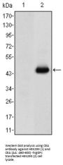 Carcinoembryonic Antigen (CEACAM5) Antibody