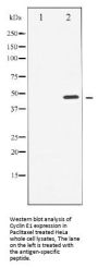 Cyclin E1 (CCNE1) Antibody