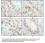 Serine/threonine-Protein Kinase Chk2 (CHK2) Antibody