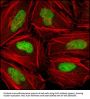 Serine/threonine-Protein Kinase Chk2 (CHK2) Antibody
