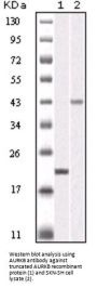 Aurora Kinase B (AURKB) Antibody