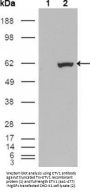 ETS Translocation Variant 1 (ETV1) Antibody