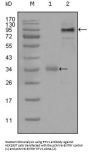 ETS Translocation Variant 1 (ETV1) Antibody
