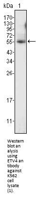 ETS Translocation Variant 4 (ETV4) Antibody