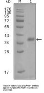 Fatty Acid-Binding Protein 4, Adipocyte (FABP4) Antibody