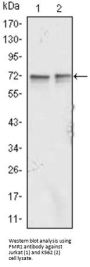 Fragile X Mental Retardation 1 (FMR1) Antibody