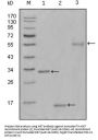 Proliferation Marker Protein Ki-67 (MKI67) Antibody