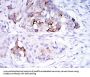 Mammaglobin-A (SCGB2A2) Antibody