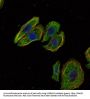 Mammaglobin-A (SCGB2A2) Antibody