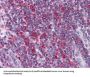 Metadherin (MTDH) Antibody