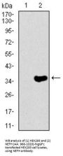 Neurofilament Heavy Polypeptide (NEFH) Antibody