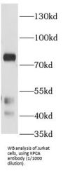 Protein Kinase C Alpha Type (PRKCA) Antibody
