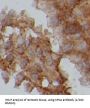 Protein Kinase C Alpha Type (PRKCA) Antibody