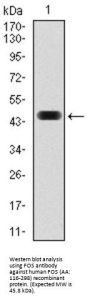 Proto-Oncogene C-Fos (FOS) Antibody