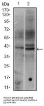 Proto-Oncogene C-Fos (FOS) Antibody