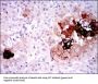 Somatostatin (SST) Antibody