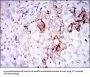 Somatostatin (SST) Antibody