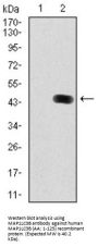 Microtubule-Associated Proteins 1A/1B Light Chain 3B (MAP1LC3B) Antibody