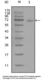 Signal Transducer And Activator of Transcription 3 (STAT3) Antibody