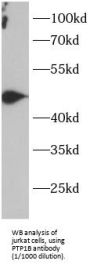 protein Tyrosine Phosphatase 1B (PTP1B) Antibody