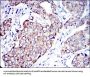 Apoptosis Inducing Factor (AIF) Antibody
