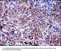 Apoptosis Inducing Factor (AIF) Antibody