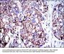 Apoptosis Inducing Factor (AIF) Antibody