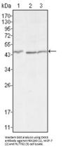 Dickkopf-Related Protein 3 (DKK3) Antibody