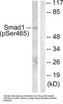 SMAD Family Member 1 Phospho-Ser465 (SMAD1 pS465) Antibody