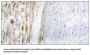 SMAD Family Member 1 Phospho-Ser465 (SMAD1 pS465) Antibody
